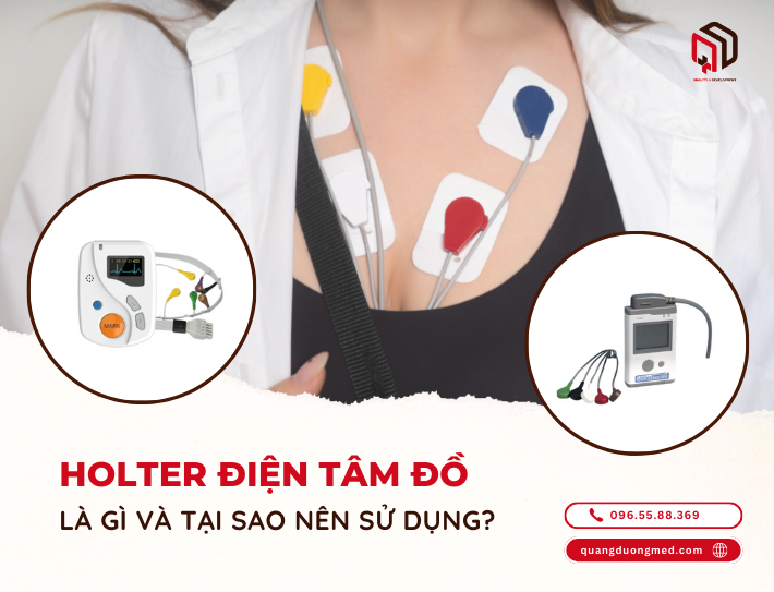 Holter điện tâm đồ là gì và tại sao nên sử dụng holter điện tâm đồ?